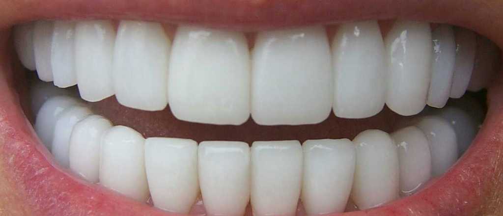 ¿Qué significa soñar que se te caen los dientes?