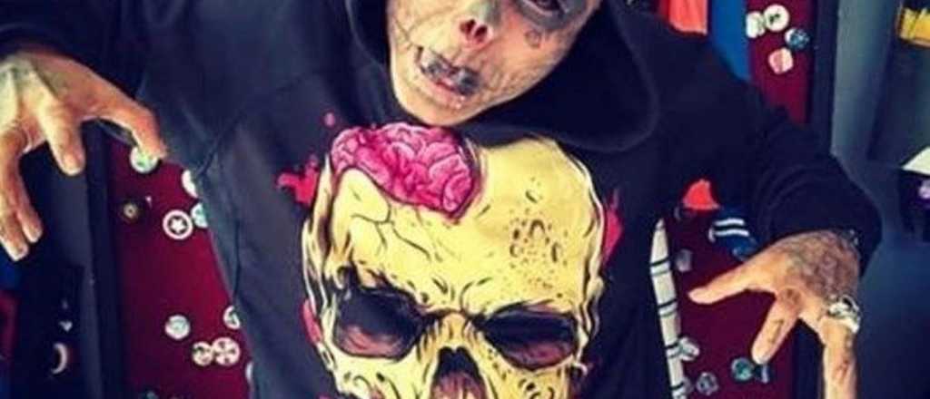 El joven que se amputó la nariz para ser una "calavera viviente"