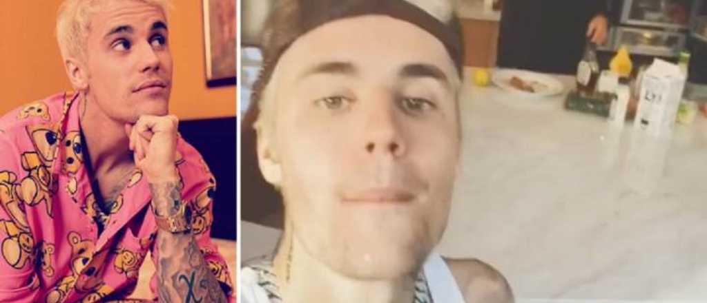 Justin Bieber confesó que padece dos graves enfermedades