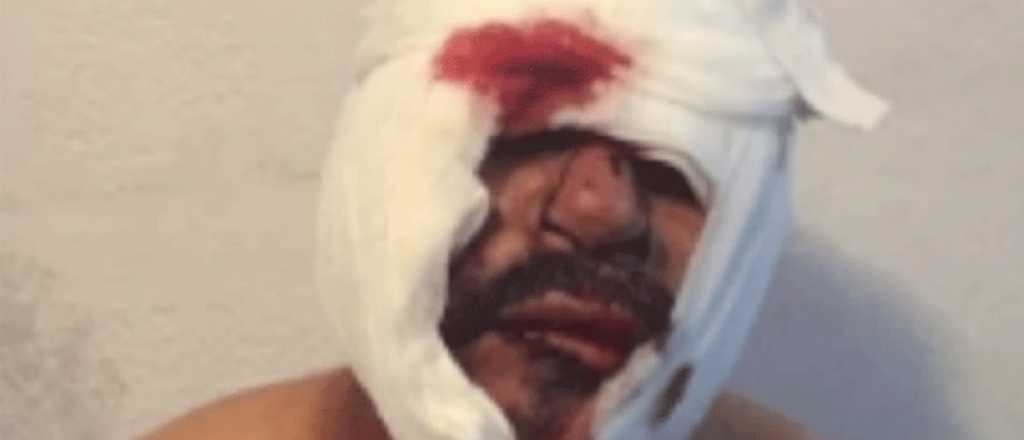 Así dejaron los vecinos a un abusador de un nene de 3 años