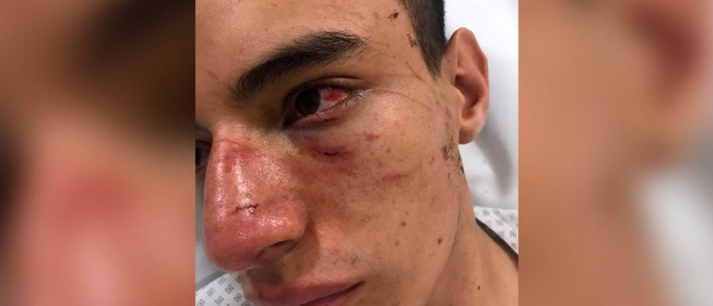 Fue golpeado entre quince personas y dijo que le pegaron por ser rugbier