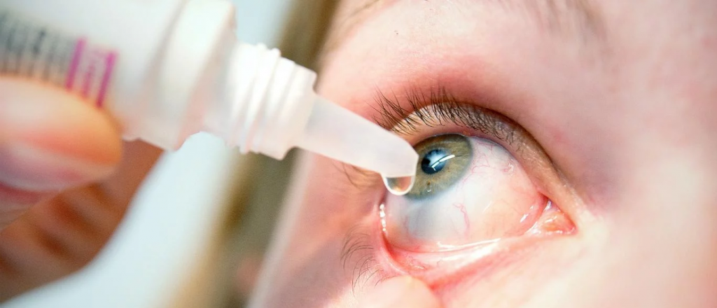 Dicen que la conjuntivitis puede ser un síntoma de coronavirus