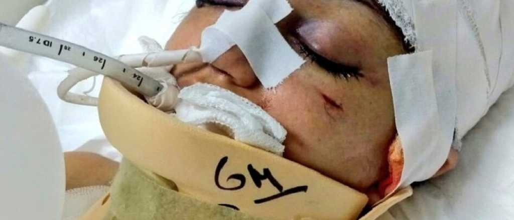 Su exmarido la dejó en coma, se recuperó y él ahora podría quedar libre