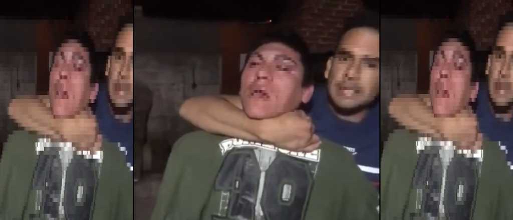 Video: vecinos le rompieron los dedos con un ladrillo a un presunto ladrón