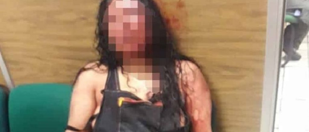 Arrestan a una mujer que caminaba con la cabeza de su marido en una bolsa