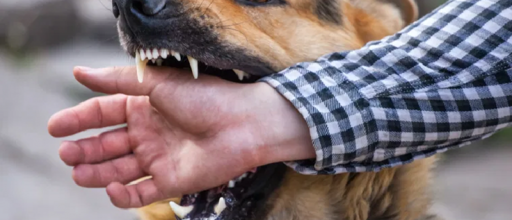 Un hombre fue atacado por perros en Maipú y sufrió heridas graves