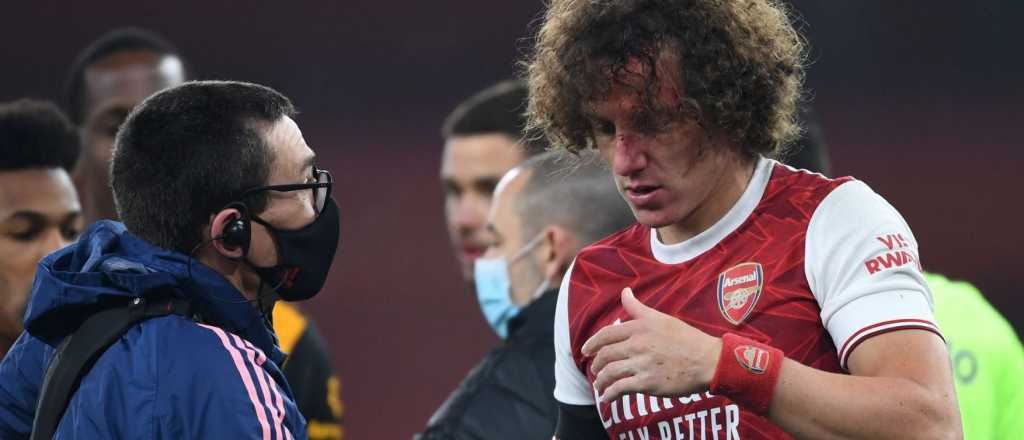 David Luiz le rompió la nariz en un entrenamiento