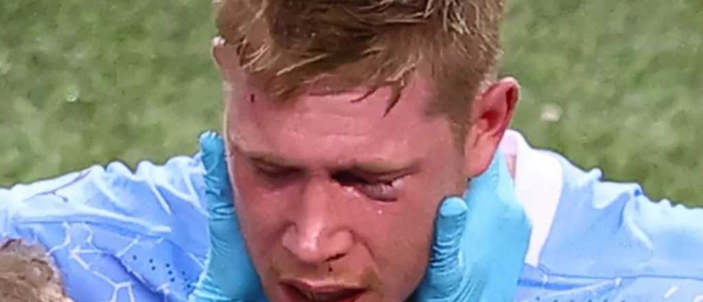 De Bruyne confirmó que tiene dos huesos de la cara rotos