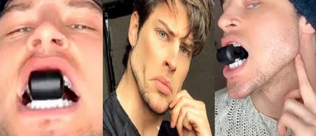 Un joven transformó su mandíbula tras ejercitarla durante años