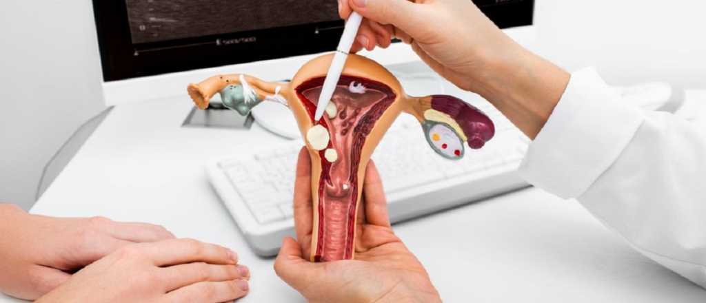 Con un análisis de orina se puede detectar el cáncer de útero