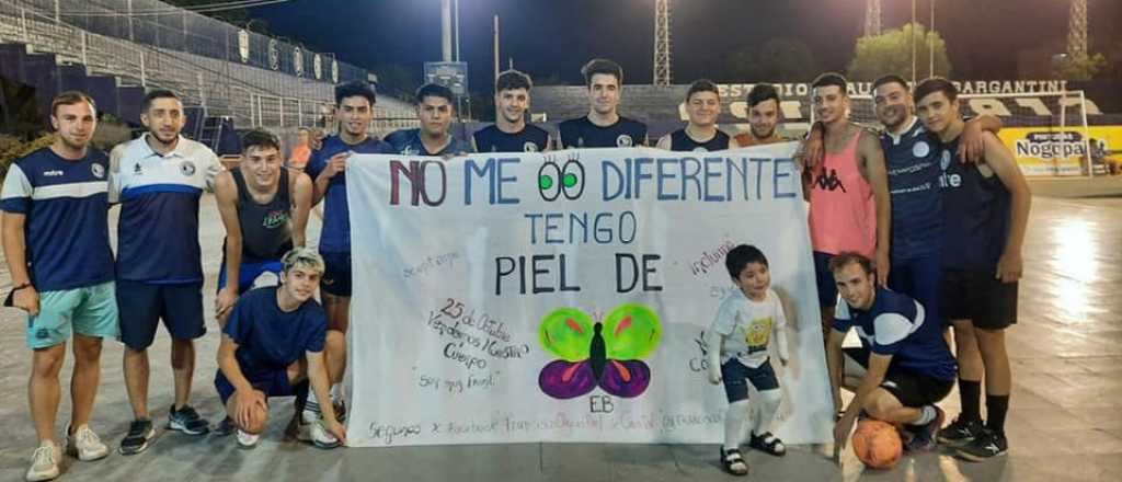 Piel de cristal: enorme gesto del plantel profesional y de Futsal de la Lepra