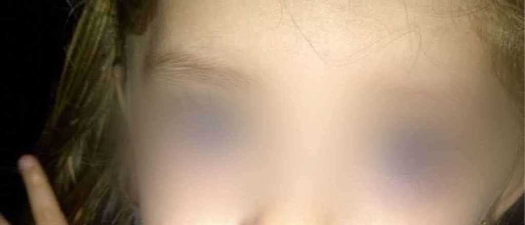 Una nena de 10 años sufre bullying y hasta le cortaron las pestañas