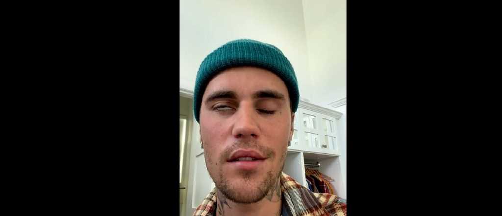 Justin Bieber sufre una parálisis facial, no puede cantar y suspendió la gira