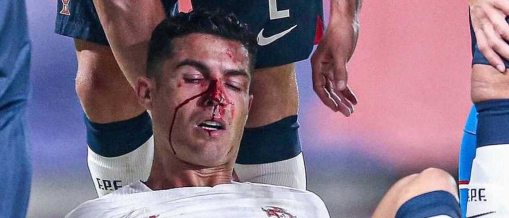 La imagen de CR7 que preocupa en Portugal a semanas del Mundial