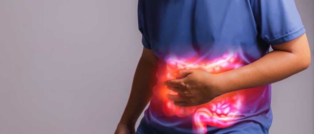 Los 6 alimentos que tenés que evitar si tenés colon irritable