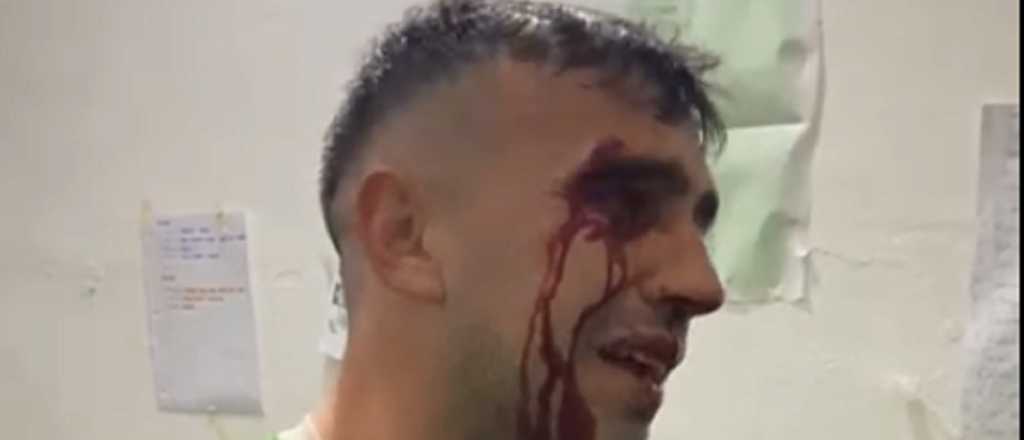 Videos: violenta pelea en la Liga Rivadaviense dejó a un jugador herido