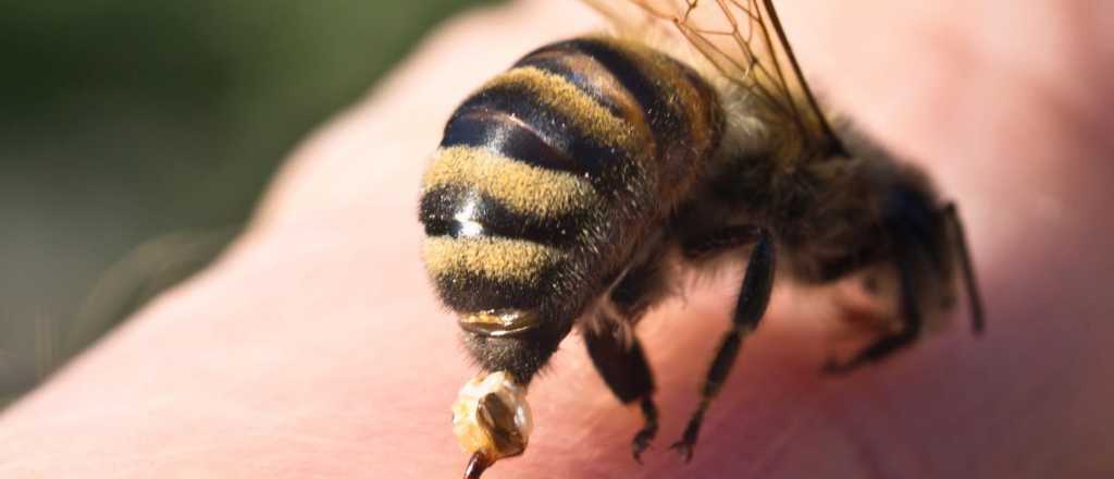 Remedios caseros para aplicar ante una picadura de abeja