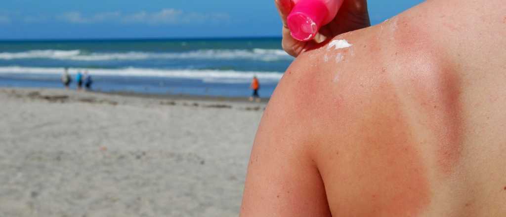 Cómo cuidar tu piel del sol en vacaciones: 5 secretos infalibles