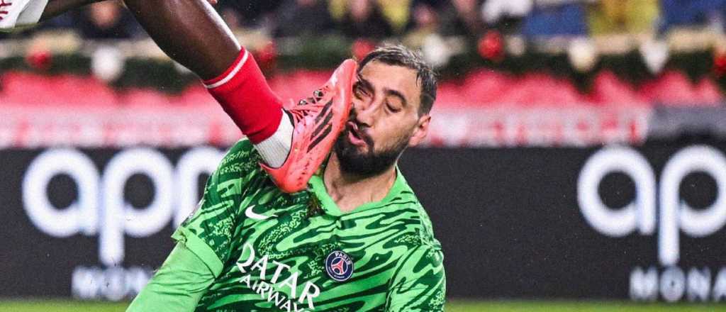 Video: a Donnarumma le abrieron la cara de un planchazo y así quedó