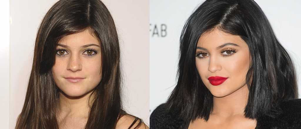 Irreconocible: así era el rostro de Kylie Jenner antes de la fama