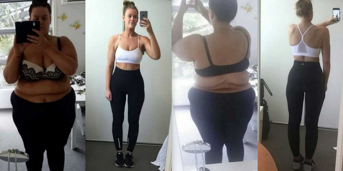 Esta Mujer Bajó 88 Kilos Y Lo Documentó En Fotos Mendoza Post