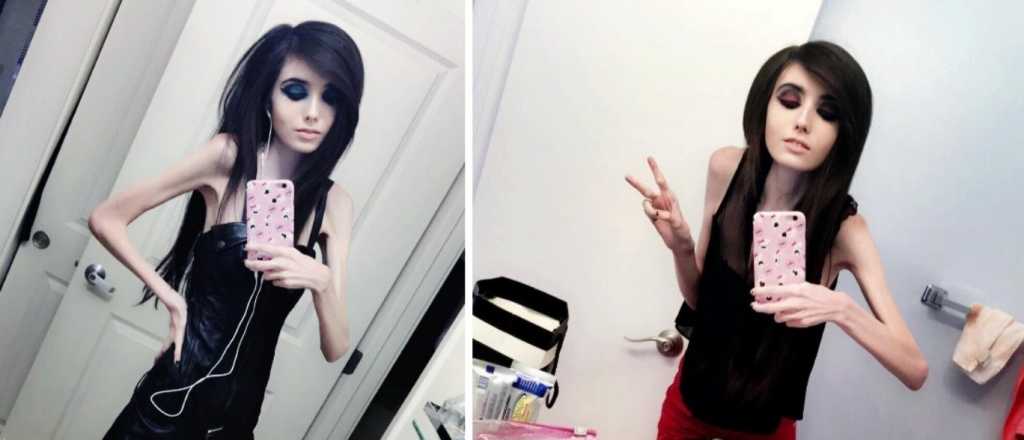 Polémica por una youtuber que pesa sólo 27 kilos